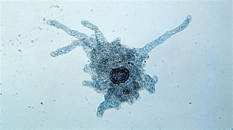  Osteocladium! Uma Ameba Fascinante Que Pode Redefinir Sua Compreensão da Vida Microscópica