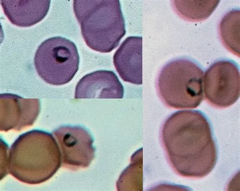  Plasmodium! A Tiny Parasite That Holds the Power to Cause Big Trouble